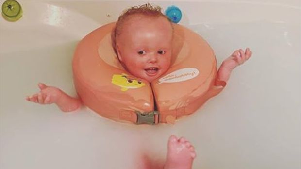 Dieses Baby Muss Alle 2 Stunden Gebadet Werden Damit Es Uberlebt