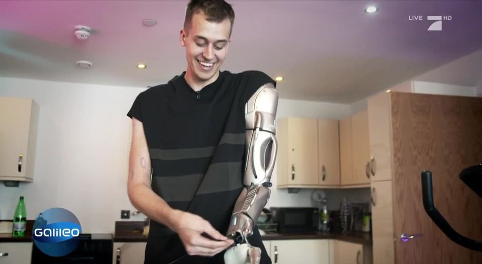 Galileo Video James Young Und Seine High Tech Prothese Prosieben