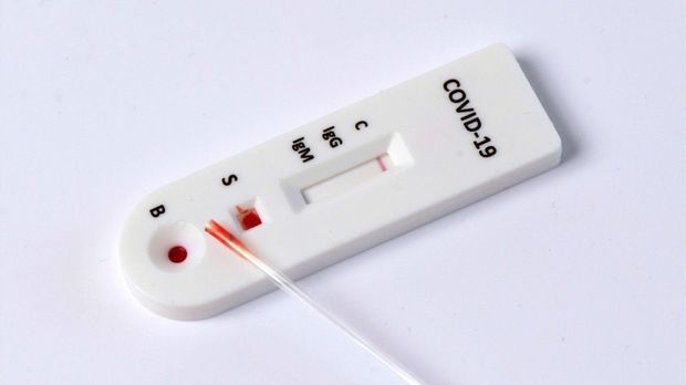 Neuer Corona-Schnelltest nach 15 Minuten: Wie sicher ist er?